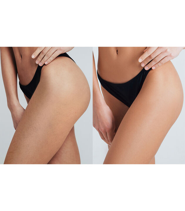 Dispositivo IPL para una depilaci&oacute;n suave y duradera. Con una cobertura 4 veces mayor, 5 ajustes regulables y un sistema de enfriamiento 360&deg;, ofrece una experiencia r&aacute;pida y c&oacute;moda para la depilaci&oacute;n corporal o facial en casa.